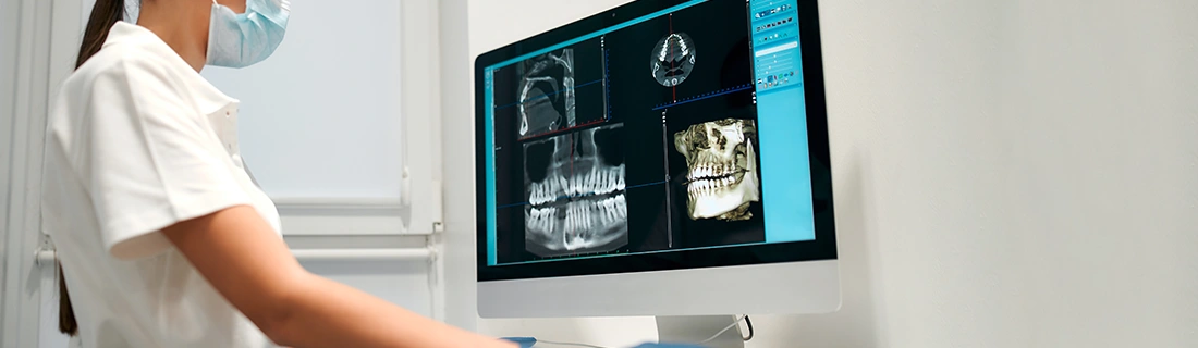 Digital Scanning vs. Impressions In Muskogee OK Digital Scanning vs. Impressions In Muskogee OK